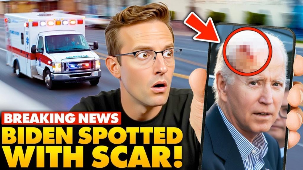 YIKES! Joe Biden Appears with Massive, Bloody Mystery SCAR Across Face and Head, Internet Horrified…