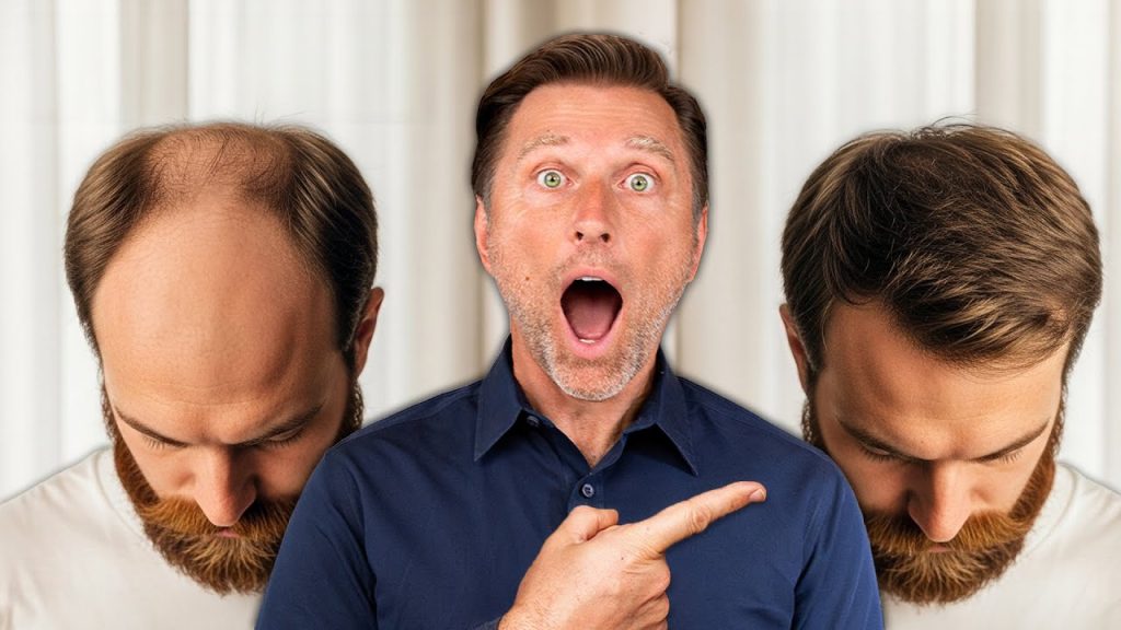 How to Reverse Hair Loss How to Reverse Hair Loss