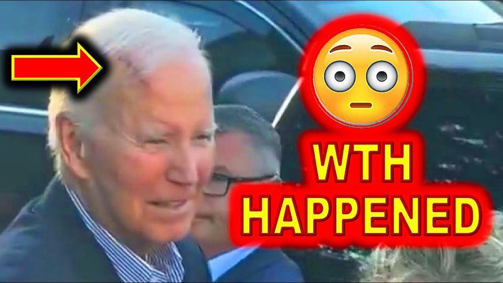 DISTURBING Clip of Joe Biden with MASSIVE Injury Released Yesterday …..